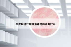 牛皮癣进行期好治还是静止期好治