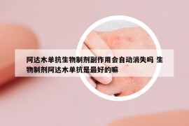 阿达木单抗生物制剂副作用会自动消失吗 生物制剂阿达木单抗是最好的嘛