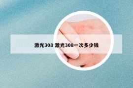 激光308 激光308一次多少钱