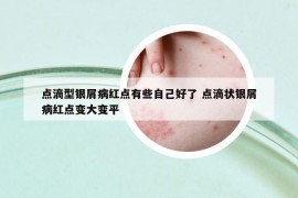 点滴型银屑病红点有些自己好了 点滴状银屑病红点变大变平