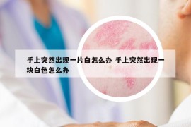 手上突然出现一片白怎么办 手上突然出现一块白色怎么办