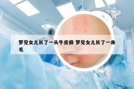 梦见女儿长了一头牛皮癣 梦见女儿长了一身毛