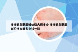 多烯磷脂酰胆碱价格大概多少 多烯磷脂酰胆碱价格大概多少钱一瓶
