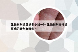 生物制剂银屑病多少钱一针 生物制剂治疗银屑病的针剂有哪些?