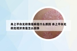 身上平白无故像是癣是什么原因 身上平白无故出现淤青是怎么回事