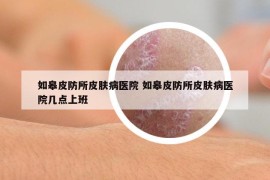 如皋皮防所皮肤病医院 如皋皮防所皮肤病医院几点上班