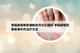 掌跖脓疱银屑病脓包可以扎破吗 掌跖脓疱型银屑病中药治疗方法