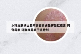 小孩皮肤病口服阿奇霉素还是环酯红霉素 阿奇霉素 环酯红霉素干混悬剂