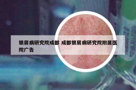 银屑病研究院成都 成都银屑病研究院附属医院广告
