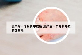 流产后一个月长牛皮癣 流产后一个月长牛皮癣正常吗