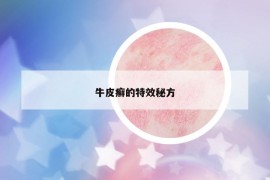 牛皮癣的特效秘方