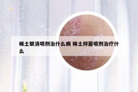 稀土银消喷剂治什么病 稀土抑菌喷剂治疗什么