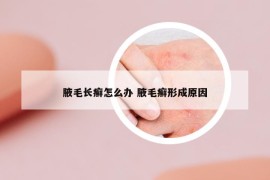 腋毛长癣怎么办 腋毛癣形成原因