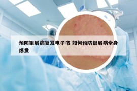 预防银屑病复发电子书 如何预防银屑病全身爆发