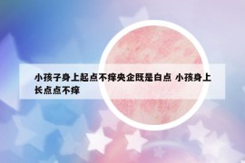 小孩子身上起点不痒央企既是白点 小孩身上长点点不痒
