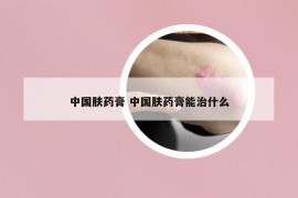 中国肤药膏 中国肤药膏能治什么