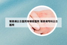 银屑病公立医院有哪些医院 银屑病专科公立医院
