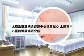 太原治银屑病选迎泽中心银屑贴心 太原市中心医院银屑病研究所