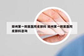 郑州第一附属医院皮肤科 郑州第一附属医院皮肤科咨询