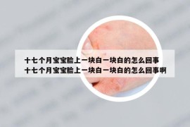 十七个月宝宝脸上一块白一块白的怎么回事 十七个月宝宝脸上一块白一块白的怎么回事啊