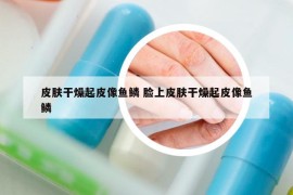 皮肤干燥起皮像鱼鳞 脸上皮肤干燥起皮像鱼鳞