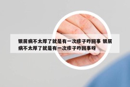 银屑病不太厚了就是有一次疹子咋回事 银屑病不太厚了就是有一次疹子咋回事呀