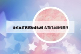 北京东直民医院皮肤科 东直门皮肤科医院