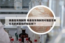 美善挺生物制剂 美善挺生物制剂对强直性脊柱炎的用量和疗程应用??