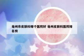 亳州市皮肤科哪个医院好 亳州皮肤科医院排名榜