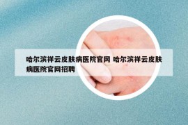 哈尔滨祥云皮肤病医院官网 哈尔滨祥云皮肤病医院官网招聘