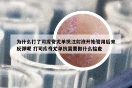 为什么打了司库奇尤单抗注射液开始管用后来反弹呢 打司库奇尤单抗需要做什么检查