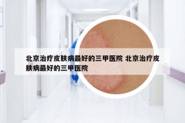 北京治疗皮肤病最好的三甲医院 北京治疗皮肤病最好的三甲医院
