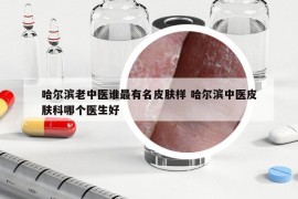 哈尔滨老中医谁最有名皮肤样 哈尔滨中医皮肤科哪个医生好