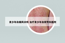 青少年白癜风诊所 治疗青少年白斑专科医院