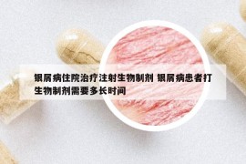 银屑病住院治疗注射生物制剂 银屑病患者打生物制剂需要多长时间
