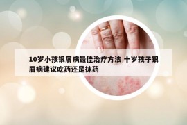 10岁小孩银屑病最佳治疗方法 十岁孩子银屑病建议吃药还是抹药
