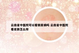 云南省中医院可以看银屑病吗 云南省中医院看皮肤怎么样