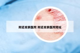 附近皮肤医院 附近皮肤医院地址