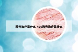 激光治疗是什么 420激光治疗是什么