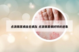 点滴银屑病自愈病友 点滴银屑病好转的迹象