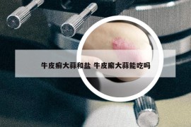 牛皮癣大蒜和盐 牛皮廨大蒜能吃吗