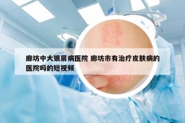 廊坊中大银屑病医院 廊坊市有治疗皮肤病的医院吗的短视频