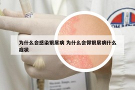 为什么会感染银屑病 为什么会得银屑病什么症状