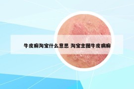 牛皮癣淘宝什么意思 淘宝主图牛皮病癣