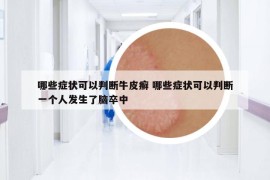 哪些症状可以判断牛皮癣 哪些症状可以判断一个人发生了脑卒中