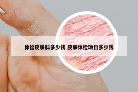 体检皮肤科多少钱 皮肤体检项目多少钱