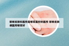 邯郸皮肤科医院是哪家最好的医院 邯郸皮肤病医院哪家好