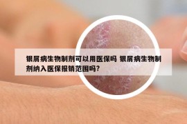 银屑病生物制剂可以用医保吗 银屑病生物制剂纳入医保报销范围吗?