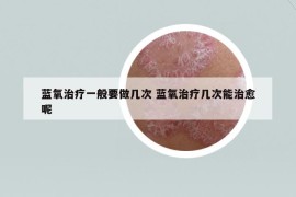 蓝氧治疗一般要做几次 蓝氧治疗几次能治愈呢