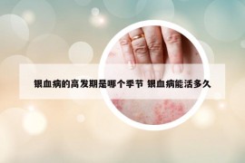 银血病的高发期是哪个季节 银血病能活多久